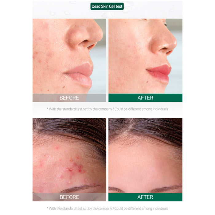 SOME BY MI AHA BHA PHA 30 Days Miracle Travel Kit Nudie Glow Australia