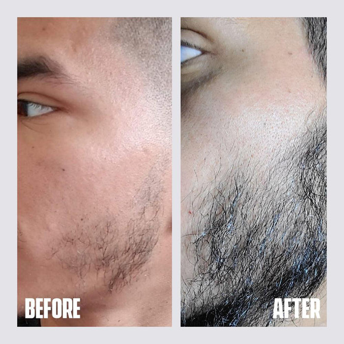 Beard Growth Kit - Dari Mooch