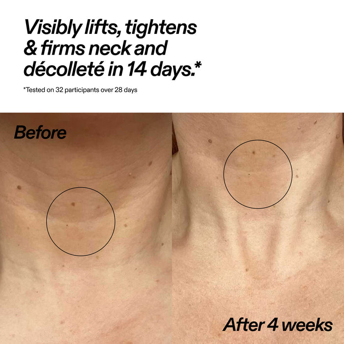 Before-and-after comparison of a person's neck and décolleté area, with text stating 'Visibly lifts, tightens & firms neck and décolleté in 14 days.' and 'After 4 weeks.