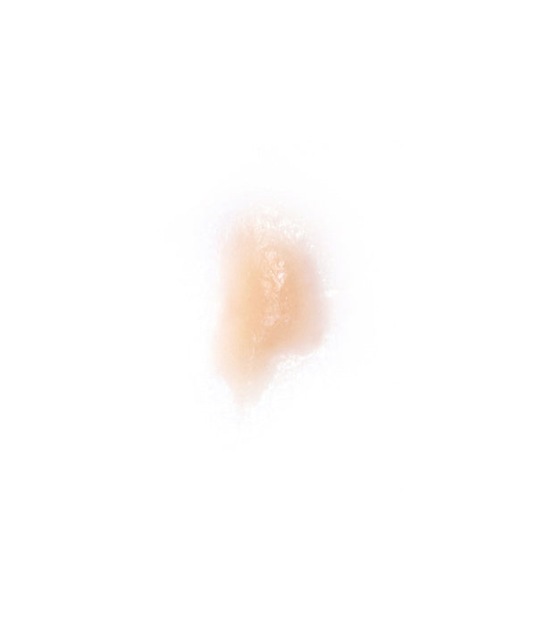 Cold Sore 5
