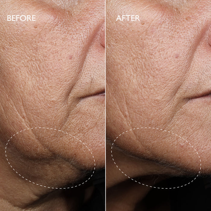 Defi Lift™ 3D-V Firming Serum