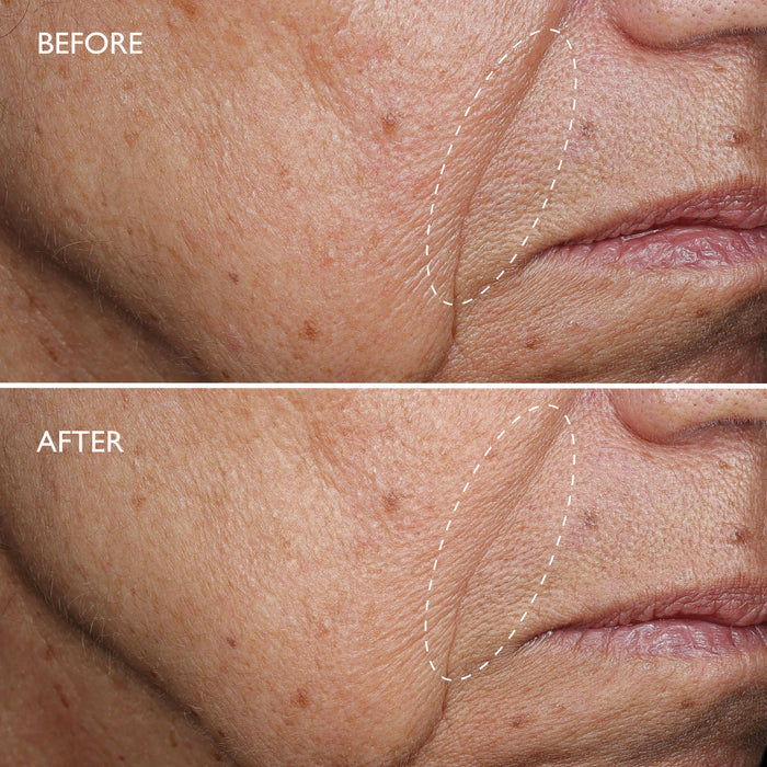 Defi Lift™ 3D-V Firming Serum