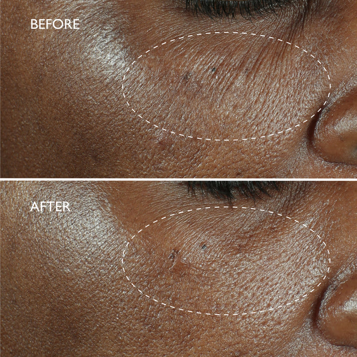Defi Lift™ 3D-V Firming Serum
