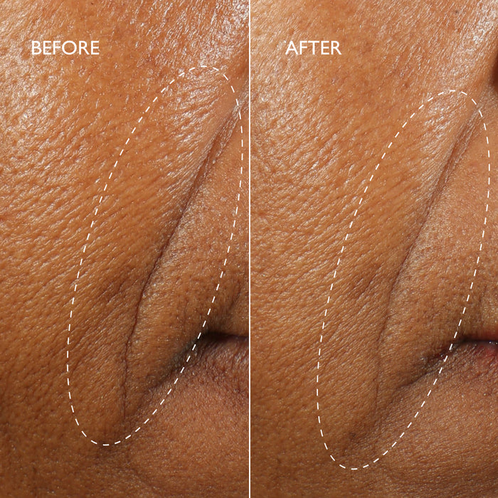 Defi Lift™ 3D-V Firming Serum