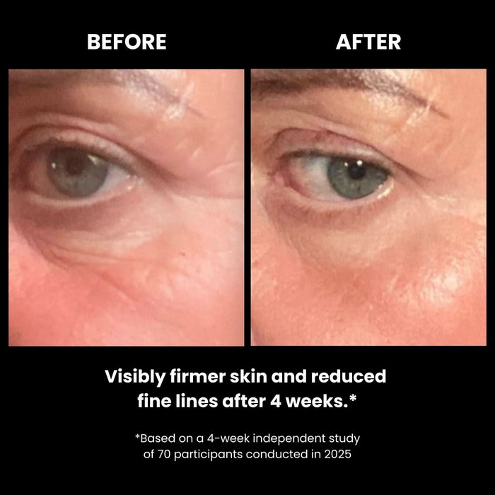 Lustre Go Glow LED Under Eye Patches