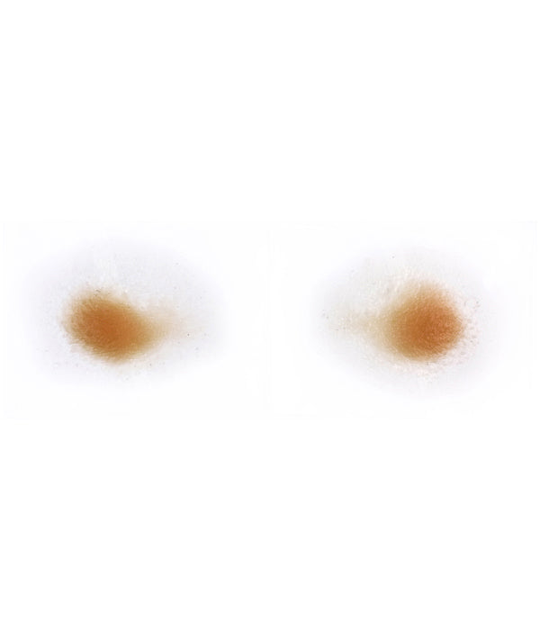 Male Jowls 1