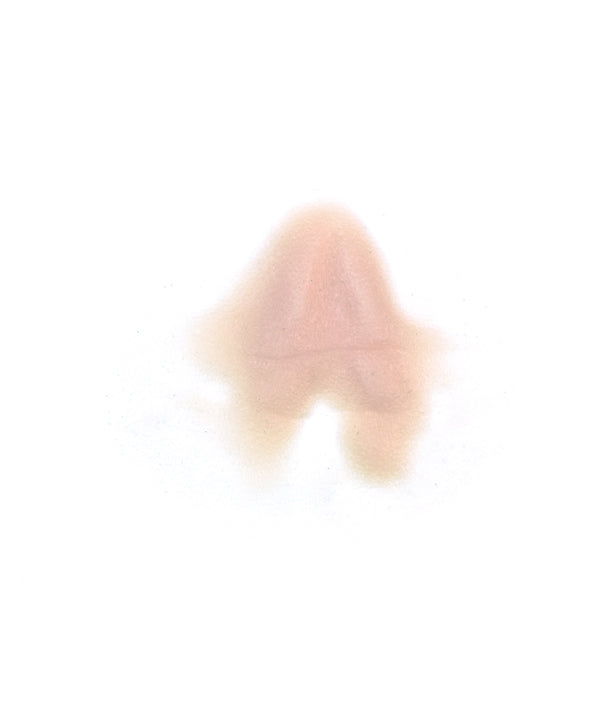 Male Neck Waddle 1