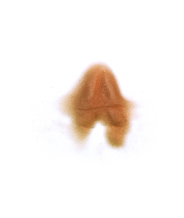 Male Neck Waddle 1
