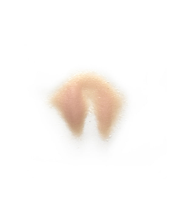 Male Neck Waddle 3