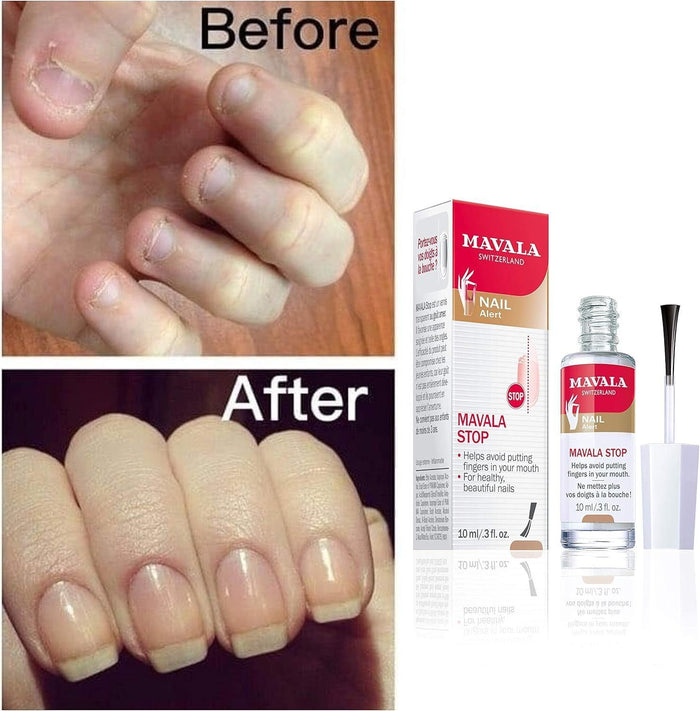 Mavala Stop Anti-Nail Biting Solution for Adults & Children, 10ml
