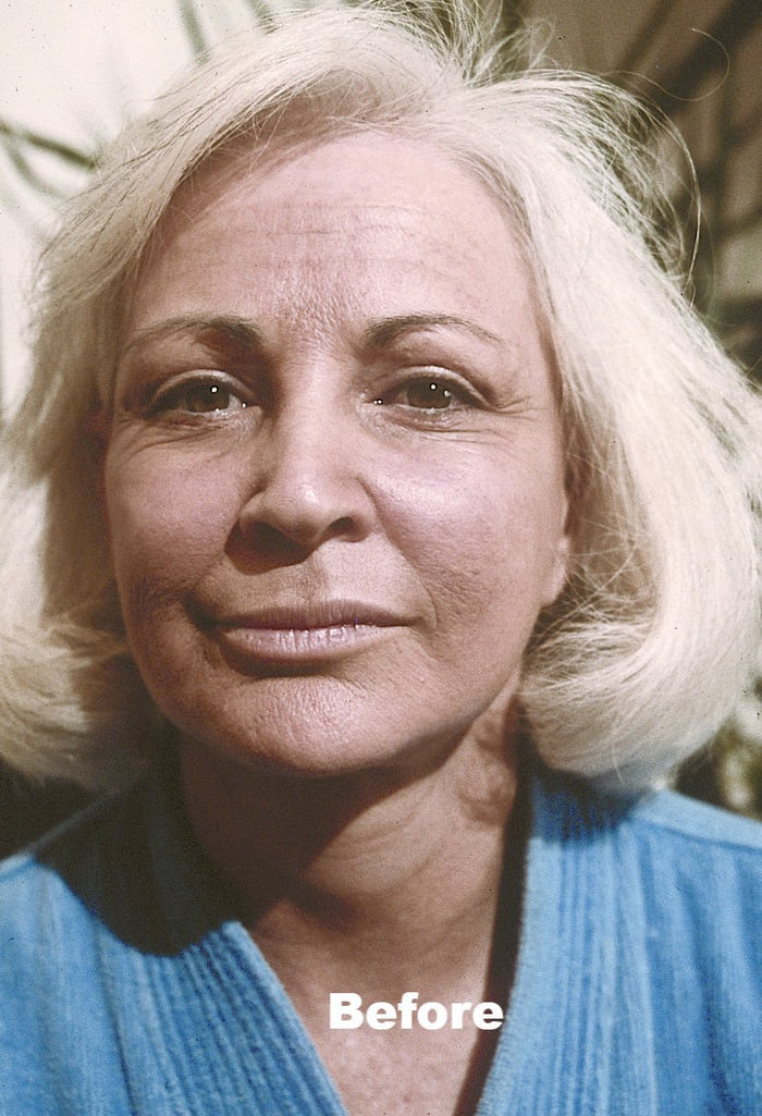 Image before applying No Lines