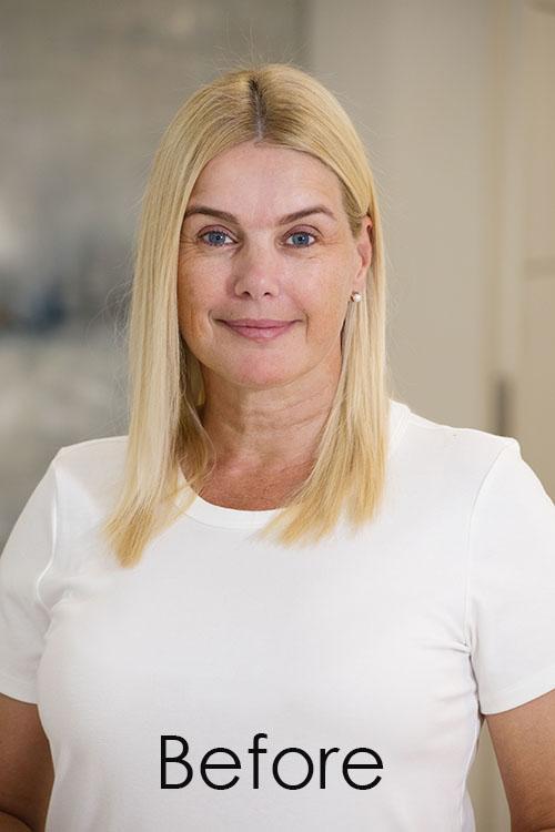Woman using temporary wrinkle remover before