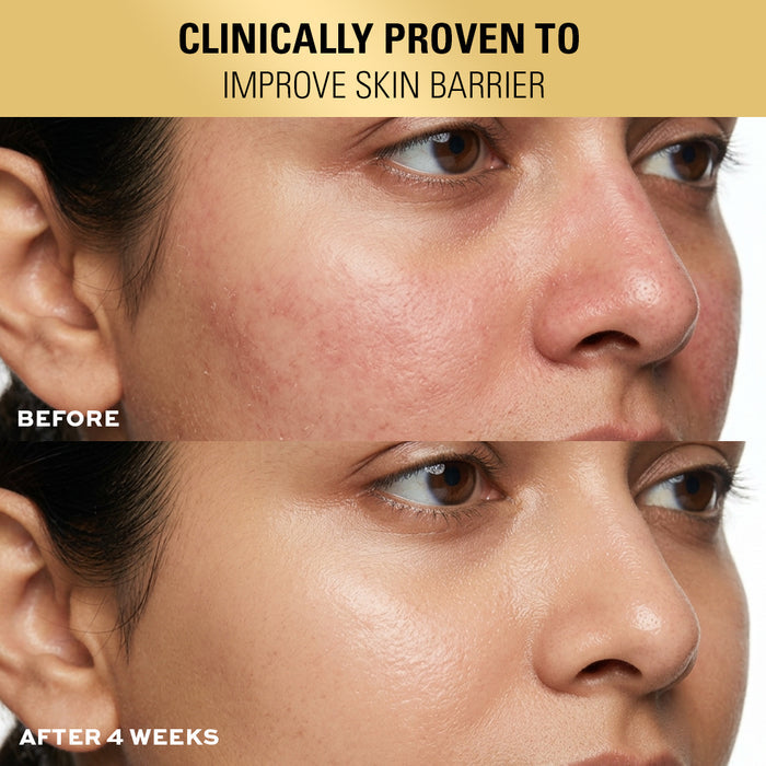 Revolution Pro Miracle 2% Salicylic Acid BHA Anti Blemish Serum
