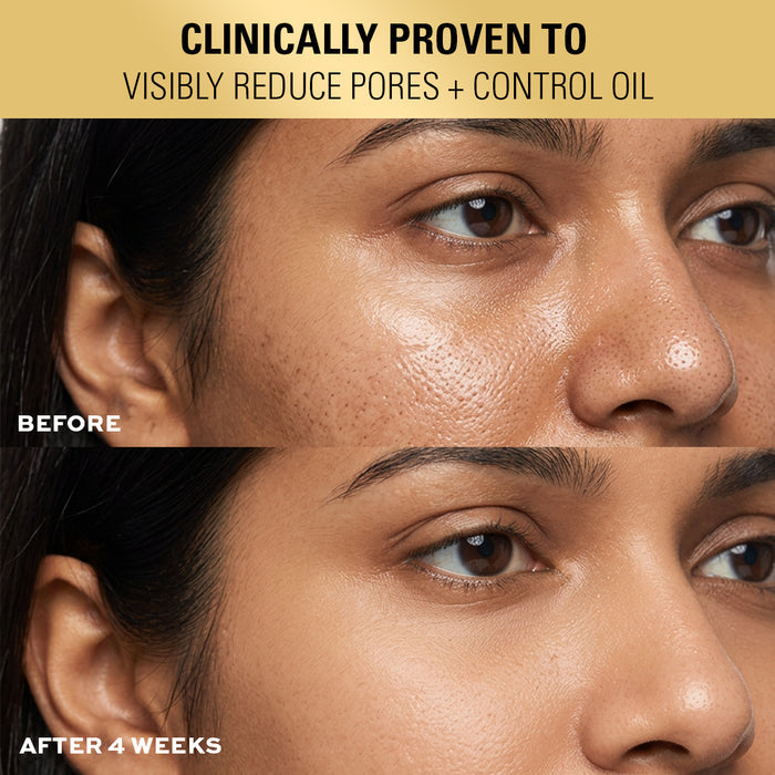 Revolution Pro Miracle 2% Salicylic Acid BHA Anti Blemish Serum