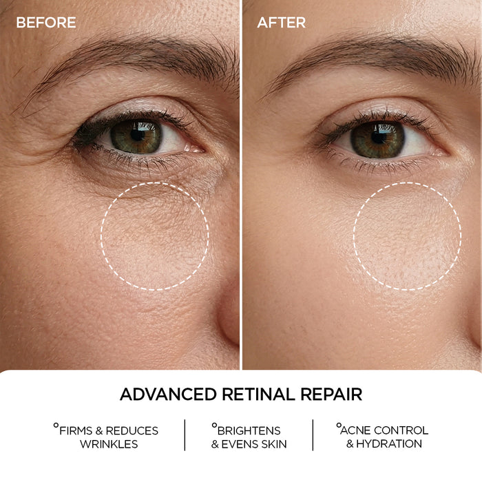 REVOX B77 JUST RETINAL 0.2% FLUID